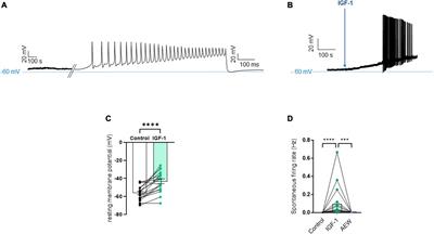 Opposite effects of acute and chronic IGF1 on rat dorsal root ganglion neuron excitability
